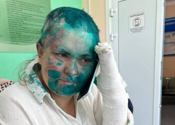 Kremlin reacts to assault on activists in Chechnya