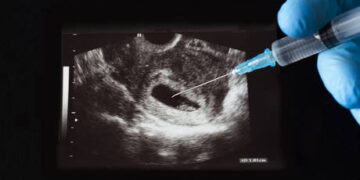 Mexico decriminalizes abortions