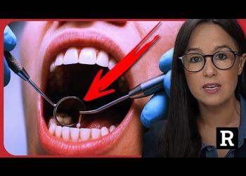 Are Cavity Fillings a Scam?