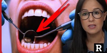 Are Cavity Fillings a Scam?