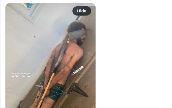 Israel responds to viral PHOTO of tortured Palestinian